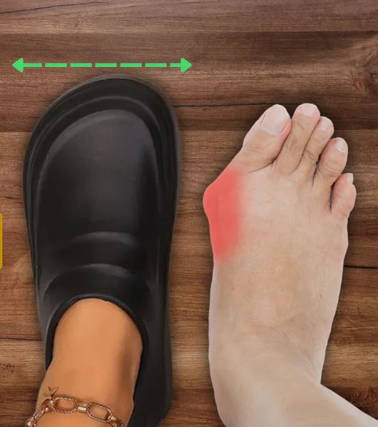 Relieve Bunion Pain: The Best Footwear Solution for Comfort and Support